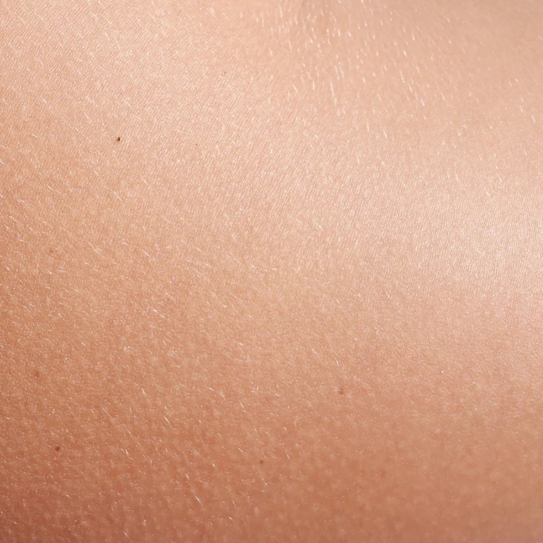 Close-up of skin texture