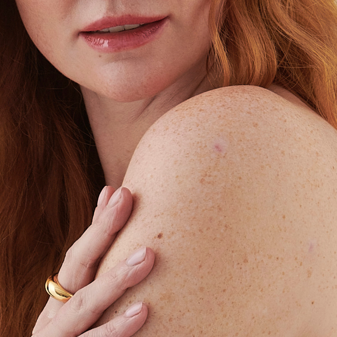 Close-up of woman's shoulder, showing healthy skin with freckles.