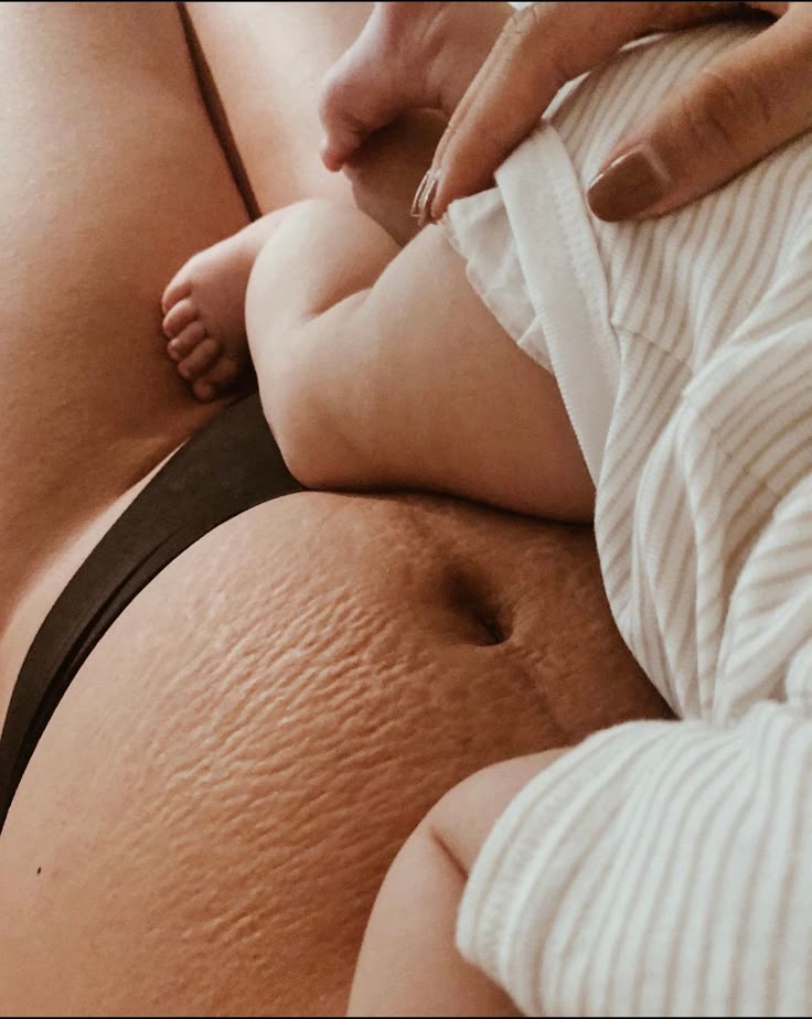 Close-up: adult abdomen with stretch marks; baby in white-and-gray stripes resting, adult hand with brown nails.