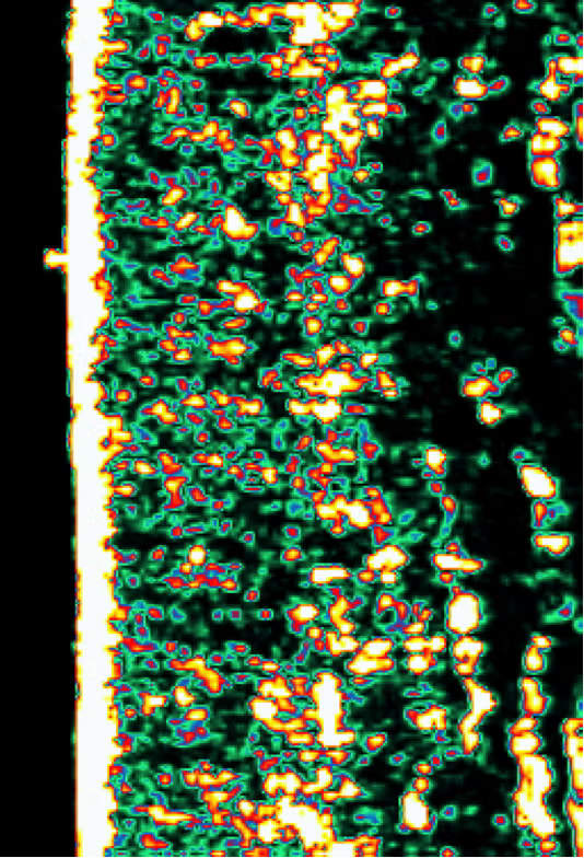 Skin Scan Showing Collagen Structure Month One
